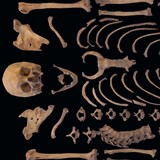 Eerste gedeelte van het skelet van een oude man (60+) met ernstige vergroeiingen © Aestimatica Archeologisch en Cultuurhistorisch Adviesbureau CC-BY-NC