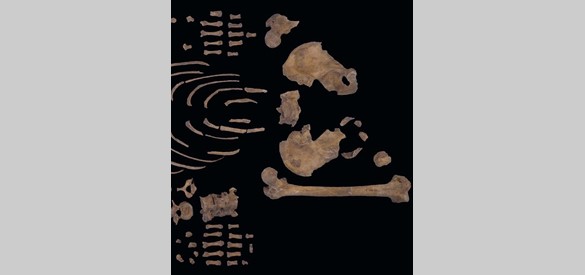 Tweede gedeelte van het skelet van een oude man (60+) met ernstige vergroeiingen